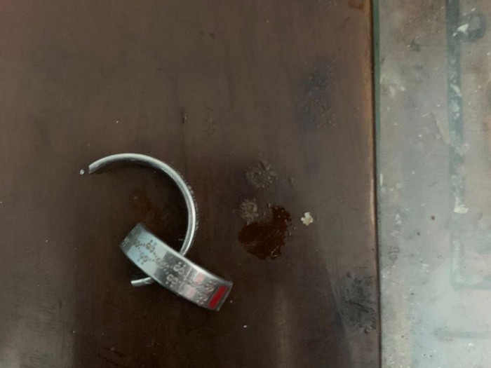 Pria Sidoarjo yang meminta tolong melepas cincin dari kemaluannya