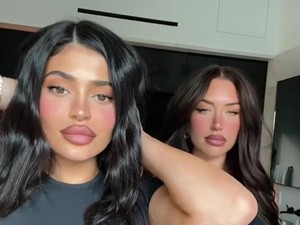 Perubahan Bibir Kylie Jenner yang Makin Jontor, Diolok-olok Efek Alergi