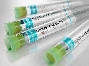 Sederet Gejala Pasien Cacar Monyet Mpox di DKI, Demam-Muncul Lesi