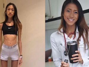 Terobsesi Kurus, Dokter Ini Sempat Punya BB 30 Kg Sampai Hampir Meninggal