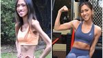Penampilan Dokter Obsesi Kurus Berujung Anoreksia Parah, BB Cuma 30 Kg