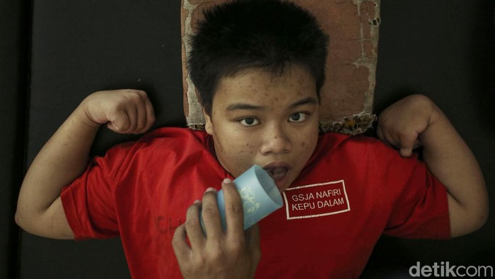 Cinta Kasih yang Buat Kami Bertahan Keterbatasan fisik, Intelektual, Mental dan Sensorik yang kini dialami orang-orang disabilitas penghuni Wisma Tuna Ganda Palsigunung. Mereka ada jadi anugerah dan cinta kasih keluarga.