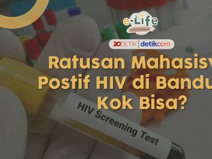 Mitos Fakta Penularan HIV, Benar Nggak Sih Bisa Kena saat Ciuman?
