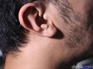 Pesan Mantan PSK Bandung yang Hidup Berdampingan dengan HIV/AIDS