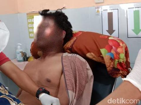ABK KLM Aven Selon 03 yang mengalami luka bakar dan harus menjalani perawatan di Puskesmas