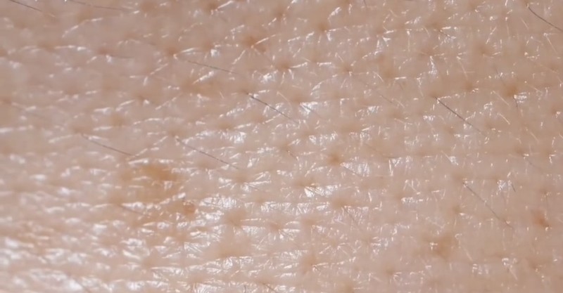 Beberapa mikroorganisme hidup pada kulit dan wajah manusia. Salah satunya adalah tungau wajah atau Demodex folliculorum.