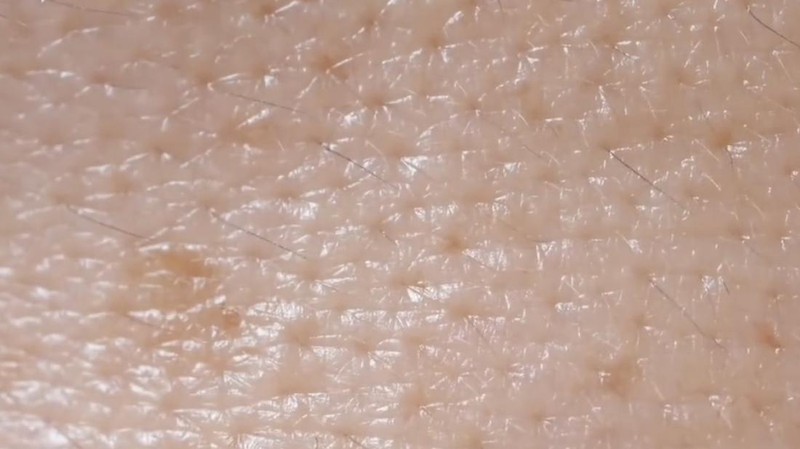 Beberapa mikroorganisme hidup pada kulit dan wajah manusia. Salah satunya adalah tungau wajah atau Demodex folliculorum.