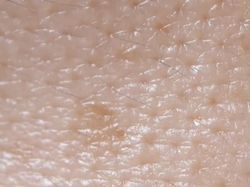 Wajah Kita Ternyata Tempat Bersarang Kutu!