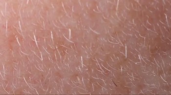 Dilansir Healthline, demodex terbagi menjadi dua jenis, di antaranya: Demodex folliculorum (D. folliculorum), yaitu Demodex yang tinggal di lapisan kulit luar, seperti pori-pori dan folikel rambut. Serta, Demodex brevis (D. brevis), yakni jenis Demodex yang tinggal di lapisan kulit yang lebih dalam, biasanya di kelenjar sebasea. Foto: dok. Instagram/ wowfact.id