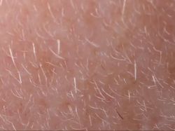 Wajah Kita Ternyata Tempat Bersarang Kutu!