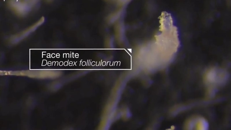 Beberapa mikroorganisme hidup pada kulit dan wajah manusia. Salah satunya adalah tungau wajah atau Demodex folliculorum.