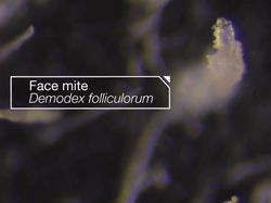 Wajah Kita Ternyata Tempat Bersarang Kutu!