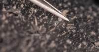 Beberapa mikroorganisme hidup pada kulit dan wajah manusia. Salah satunya adalah tungau wajah atau Demodex folliculorum.