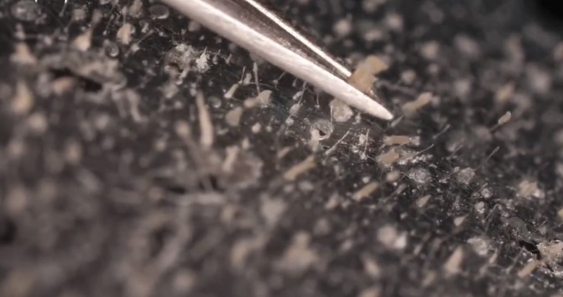 Beberapa mikroorganisme hidup pada kulit dan wajah manusia. Salah satunya adalah tungau wajah atau Demodex folliculorum.