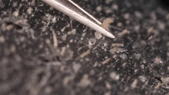 Hampir semua manusia memilikinya. Hewan tersebut menghabiskan hidup di atas wajah kita. Mereka makan, berkembang biak dan akhirnya mati. Foto: dok. Instagram/ wowfact.id