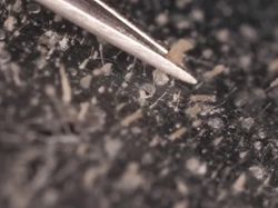 Wajah Kita Ternyata Tempat Bersarang Kutu!