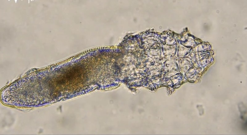 Beberapa mikroorganisme hidup pada kulit dan wajah manusia. Salah satunya adalah tungau wajah atau Demodex folliculorum.