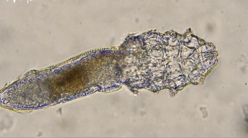 Hewan ini tidak dapat dilihat dengan mata telanjang karena ukurannya yang sangat kecil. Foto: dok. Instagram/ wowfact.id