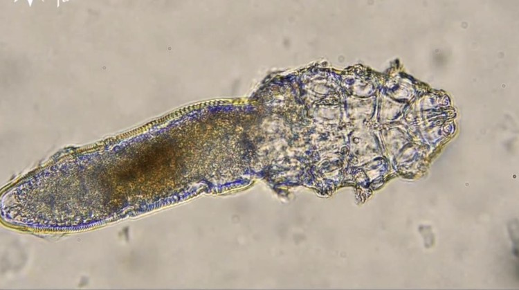 Beberapa mikroorganisme hidup pada kulit dan wajah manusia. Salah satunya adalah tungau wajah atau Demodex folliculorum.