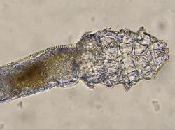 Wajah Kita Ternyata Tempat Bersarang Kutu!