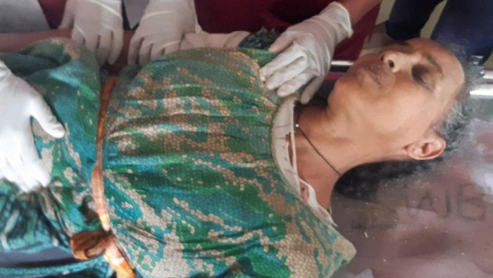 A woman injured in an air strike receives treatment at a hospital in Mekelle, the capital of Tigray region, Ethiopia August 26, 2022. REUTERS/Stringer NO RESALES. NO ARCHIVES.
