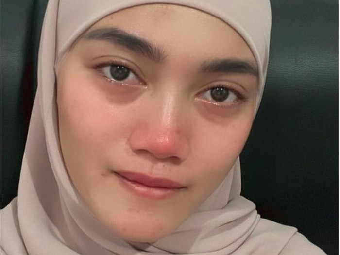 Jess Amalia umumkan keguguran.