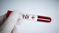 Heboh Skandal Transfusi Darah, Ribuan Orang di Inggris Terinfeksi HIV-Hepatitis