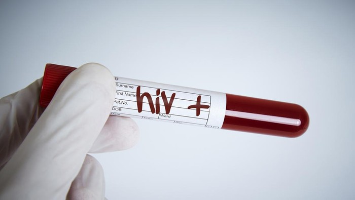 Ilustrasi HIV-AIDS pada Anak Laboratory Request, Hiv Test, Hiv Positive