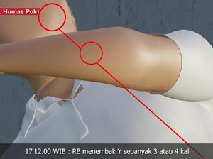 4 Bagian Tubuh Brigadir J yang Kena Tembakan Bharada E