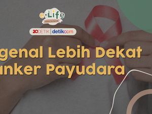 Ciri-ciri Kanker Payudara, Bisa Jadi Sering Tak Disadari