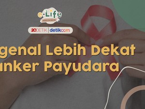 Ciri-ciri Kanker Payudara, Bisa Jadi Sering Tak Disadari