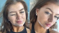 Viral seorang wanita bernama Karli Gardner yang menunjukkan kondisi bibirnya yang membengkak pasca melakukan filler bibir. Kondisi ini diunggahnya melalui video di akun Tiktok miliknya @karligardnerxx. (Teks: Alethea Pricila; Foto: Tangkapan Layar TikTok @karligardnerxx)