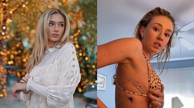 7 Foto Wanita Cantik yang Paru-parunya Bocor Gegara Ngevape