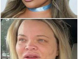 Foto Perbedaan Jauh Instagram Vs Realita, Asli Bikin Kaget!