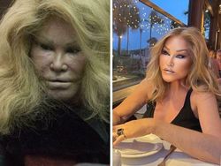 Foto Perbedaan Jauh Instagram Vs Realita, Asli Bikin Kaget!