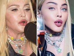 Foto Perbedaan Jauh Instagram Vs Realita, Asli Bikin Kaget!