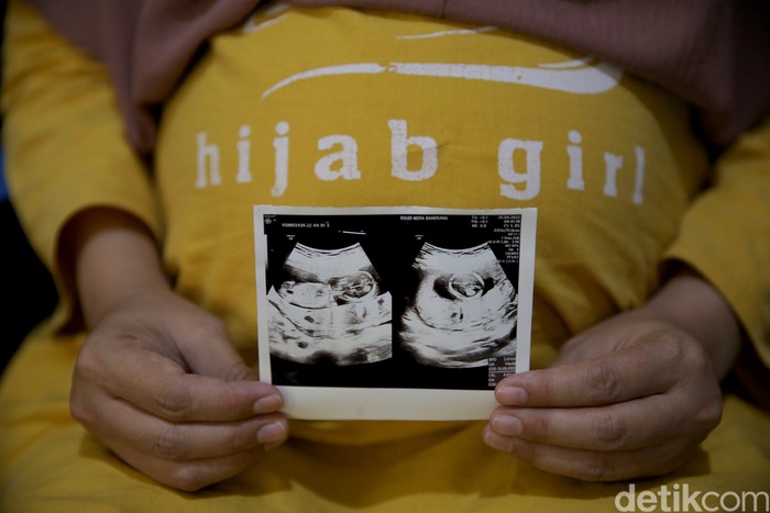 Pasangan H dan A positif HIV yang berdomisili di Bandung. H kini tengah mengandung 8 bulan.