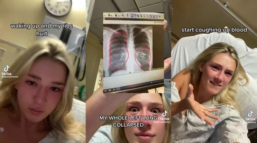 viral paru-paru kolaps gegara vape