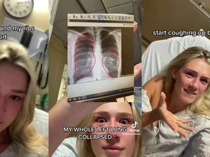 Viral Wanita 23 Tahun Curhat Hampir Mati Gegara Vape: Paru Rusak-Batuk Darah
