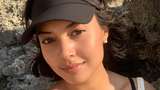 Aurelie Moeremans Idap Tumor Colli, Inikah Penyebabnya?