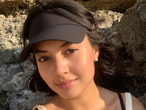 Aurelie Moeremans Idap Tumor Colli, Inikah Penyebabnya?