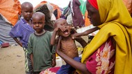 Wajah Anak-anak Somalia yang Kena Gizi Buruk, Beneran Menyedihkan