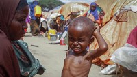 Anak kecil dengan kondisi gizi buruk menjadi pemandangan sehari-hari di sini. Selain kekeringan akibat perubahan iklim, konflik dan kemiskinan memicu daftar panjang masalah di negeri tersebut.  