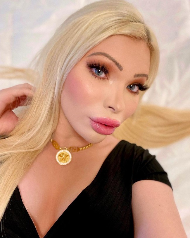 Aku sangat senang dengan hasilnya. Aku pikir hasilnya bagus, operasi itu benar-benar mengubah proporsi tubuhku dan memberiku tampilan sintal yang aku inginkan, katanya dilansir NY Post.Foto: Instagram @theserenasmith