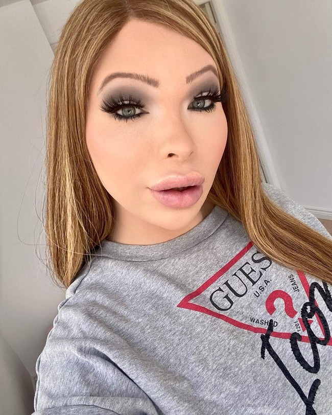 Serena sendiri mengetahui bahwa operasi plasti yang dijalani bisa berbahaya, terutama operasi bokong. Karena itu, Serena memilih dokter yang terpercaya. Untuk prosedur tersebut, dokter mengambil lemak dari perut dari liposuction untuk ditransfer ke bokong dan pinggul.Foto: Instagram @theserenasmith