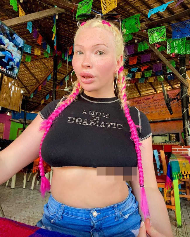 Selain risiko kesehatan, Serena mengetahui bahwa penampilannya bisa mengundang kritik netizen. Namun hal itu tidak ingin terlalu dipikirkannya. Aku tidak menyakiti siapapun dengan pilihanku. Aku ingin menyebarkan hal positif di Instagram dan harus jadi tempat aman bagi fans dan follower yang berinteraksi denganku. Dalam hidup, kamu tidak akan pernah bisa menyenangkan siapa pun untuk bisa senang dan positif, katanya.Foto: Instagram @theserenasmith