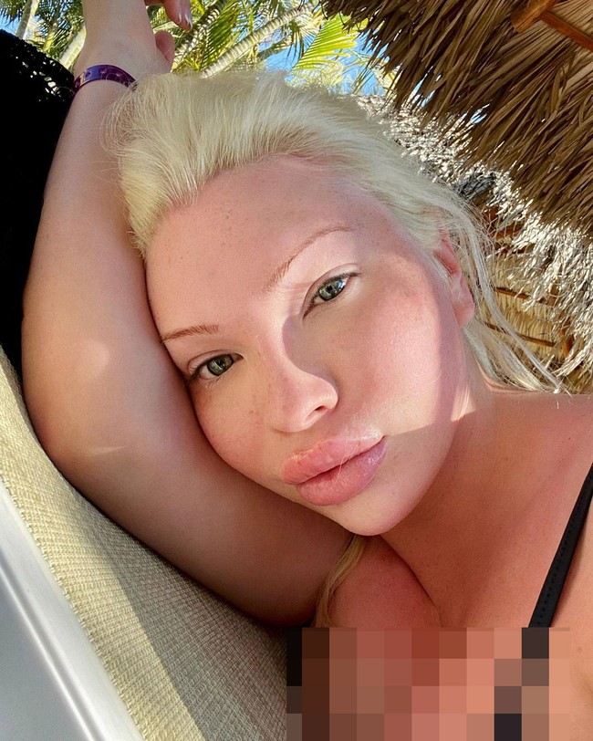 Di Instagram, banyak netizen berkomentar mengenai hasil operasi Serena.Foto: Instagram @theserenasmith