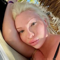 Di Instagram, banyak netizen berkomentar mengenai hasil operasi Serena.Foto: Instagram @theserenasmith