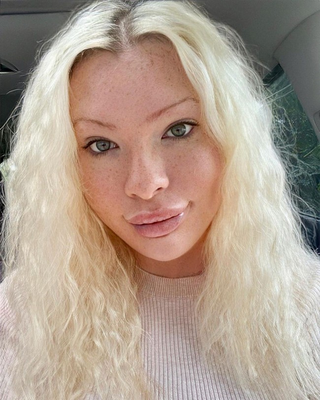 Banyak yang mendukung tapi banyak pula yang menganggap ia tidak mirip Marilyn Monroe. Marilyn Monroe atau Marilyn Manson? Semua operasi itu tapi kamu lebih mirip Jeffree Star, Mengapa kamu melakukannya? Kamu malah terlihat seperti pria, tulis yang lain.Foto: Instagram @theserenasmith