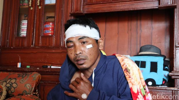 Udes, warga Sumedang yang jadi korban serangan macan kumbang.